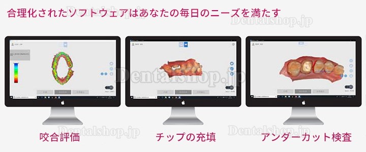 Runyes 3DS 歯科用デジタル口腔内スキャナー パウダーレスリアルカラースキャン